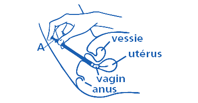 MycoHydralin 500mg Mycose Vaginale 1 Comprimé