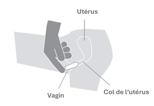 schema